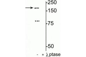 Western blot of rat hippocampal lysate showing specific immunolabeling of the ~180 kDa NR2B subunit of the NMDAR phosphorylated at Tyr1472 in the first lane (-). (GRIN2B Antikörper  (pTyr1472))
