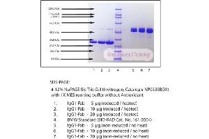 Gel Scan of Immunoglobulin G1 (IgG1), Human Myeloma Plasma, Fab Fragment  This information is representative of the product ART prepares, but is not lot specific. (IgG1 Protein (Fab Region))