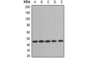 Western blot analysis of Aminoacylase 1 expression in A431 (A), Jurdat (B), mouse brain (C), mouse liver (D), rat kidney (E) whole cell lysates. (Aminoacylase 1 Antikörper)