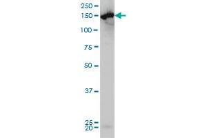 CPS1 monoclonal antibody (M01), clone 8H8 Western Blot analysis of CPS1 expression in HeLa . (CPS1 Antikörper  (AA 1400-1500))