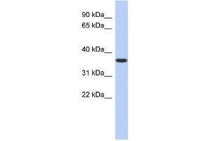 WB Suggested Anti-MVK Antibody Titration: 0.