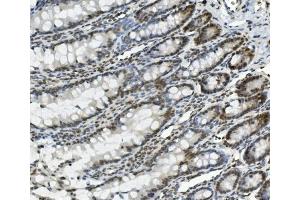 IHC analysis of PRDM5 using anti-PRDM5 antibody (ABIN7600853). (PRDM5 Antikörper  (AA 24-630))