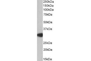 Western Blotting (WB) image for anti-Myeloid Differentiation Primary Response Gene (88) (MYD88) (Internal Region) antibody (ABIN185362)
