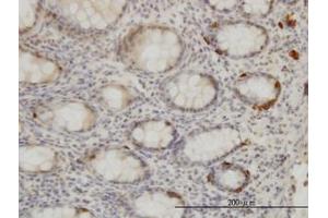 Image no. 1 for anti-Tribbles Pseudokinase 2 (TRIB2) (AA 254-344) antibody (ABIN599226)