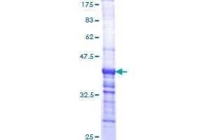 Image no. 1 for Laminin, alpha 2 (LAMA2) (AA 3013-3122) protein (GST tag) (ABIN1309119)