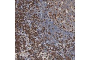 Immunohistochemical staining of human lymph node with SH3KBP1 polyclonal antibody  shows strong cytoplasmic positivity.