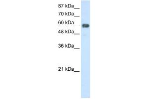 WB Suggested Anti-TROVE2 Antibody Titration:  2. (TROVE2 Antikörper  (N-Term))