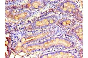 Immunohistochemistry of paraffin-embedded human small intestine tissue using ABIN7159734 at dilution of 1:100 (MTTP Antikörper  (AA 19-151))