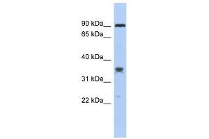 C6ORF154 antibody used at 1 ug/ml to detect target protein. (C6orf154 Antikörper  (Middle Region))
