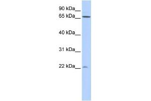 WB Suggested Anti-DIRAS1 Antibody Titration: 0. (DIRAS1 Antikörper  (N-Term))