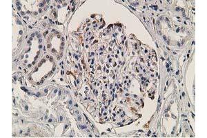 Immunohistochemical staining of paraffin-embedded Human Kidney tissue using anti-OGFOD1 mouse monoclonal antibody. (OGFOD1 Antikörper)
