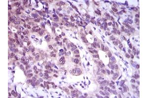 Image no. 1 for anti-ATP Citrate Lyase (ACLY) antibody (ABIN1491378) (ACLY Antikörper)