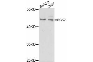 Western blot analysis of extracts of various cell lines, using SGK2 antibody (ABIN5998798) at 1/1000 dilution. (SGK2 Antikörper)