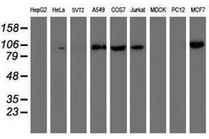 Image no. 1 for anti-phosphofructokinase, Platelet (PFKP) antibody (ABIN1500165) (PFKP Antikörper)