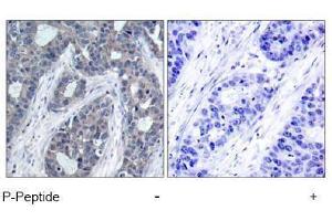 Image no. 1 for anti-Insulin Receptor Substrate 1 (IRS1) (pSer636) antibody (ABIN196979) (IRS1 Antikörper  (pSer636))