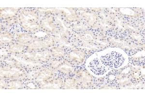 Immunohistochemistry (IHC) image for anti-Wingless-Type MMTV Integration Site Family, Member 1 (WNT1) (AA 28-370) antibody (ABIN7430084)