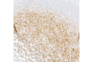 Immunohistochemistry (IHC) image for anti-Complement Component (3d/Epstein Barr Virus) Receptor 2 (CR2) (C-Term) antibody (ABIN7795815) (Rekombinanter CD21 Antikörper  (C-Term))