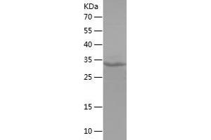 Western Blotting (WB) image for serine/threonine/tyrosine Kinase 1 (STYK1) (AA 53-176) protein (His-IF2DI Tag) (ABIN7125045) (STYK1 Protein (AA 53-176) (His-IF2DI Tag))