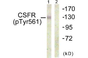 Immunohistochemistry analysis of paraffin-embedded human brain using CSFR (Phospho-Tyr561) antibody. (CSF1R Antikörper  (pTyr561))