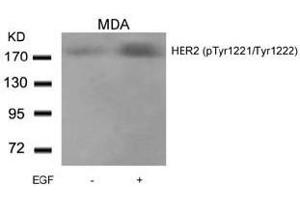 Image no. 2 for anti-Receptor tyrosine-protein kinase erbB-2 (ErbB2/Her2) (pTyr1221), (pTyr1222) antibody (ABIN196750) (ErbB2/Her2 Antikörper  (pTyr1221, pTyr1222))