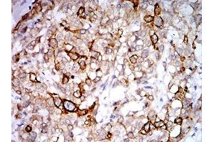 Immunohistochemistry (IHC) image for anti-Progesterone Receptor Membrane Component 1 (PGRMC1) (AA 1-195) antibody (ABIN5542351)