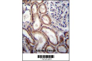 SLIT1 Antibody immunohistochemistry analysis in formalin fixed and paraffin embedded human kidney tissue followed by peroxidase conjugation of the secondary antibody and DAB staining.