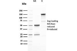 SDS-PAGE Analysis Purified HER-2 Mouse Monoclonal Antibody (ERBB2/3080). (ErbB2/Her2 Antikörper  (AA 311-462))