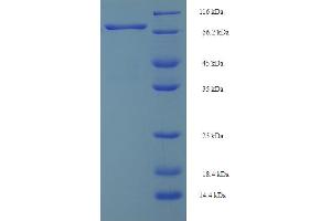 SDS-PAGE (SDS) image for Spermine Oxidase (SMOX) (AA 1-555), (full length) protein (His-SUMO Tag) (ABIN5710382) (SMOX Protein (AA 1-555, full length) (His-SUMO Tag))