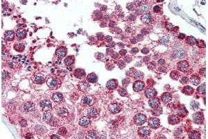 anti-Superoxide Dismutase 2, Mitochondrial (SOD2) antibody