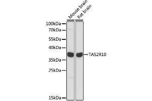 Western blot analysis of extracts of various cell lines, using TAS2R10 antibody. (TAS2R10 Antikörper)