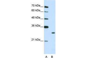 Western Blotting (WB) image for anti-Muscleblind-like Protein 1 (MBNL1) antibody (ABIN2462372) (MBNL1 Antikörper)