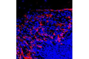 Immunofluorescent analysis of paraffin embedded human tonsil using CK6 (ABIN7074423) at dilution of 1: 2000 (Keratin 6 Antikörper)