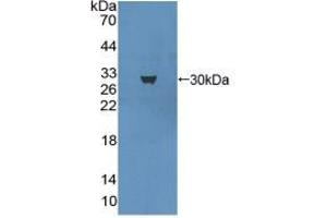 Western blot analysis of recombinant Mouse MAP1A. (MAP1A Antikörper  (AA 2552-2759))