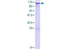 Image no. 1 for Angiomotin (AMOT) (AA 1-675) protein (GST tag) (ABIN1344994) (Angiomotin Protein (AMOT) (AA 1-675) (GST tag))