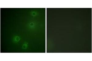 Immunofluorescence analysis of COS7 cells, using Integrin beta1 (Phospho-Thr789) Antibody. (ITGB1 Antikörper  (pThr789))