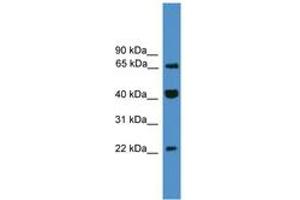 Image no. 1 for anti-Transcription Elongation Factor A (SII)-Like 6 (TCEAL6) (C-Term) antibody (ABIN6745441) (TCEAL6 Antikörper  (C-Term))