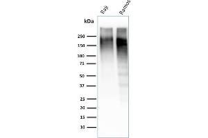 Western Blot Analysis of Raji and Ramos cell lysate using Ki67-Monospecific Mouse Monoclonal Antibody (MKI67/2462). (Ki-67 Antikörper  (AA 2293-2478))