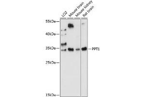Western blot analysis of extracts of various cell lines, using PPT1 antibody (ABIN7269164) at 1:1000 dilution. (PPT1 Antikörper  (AA 28-306))