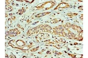 Immunohistochemistry of paraffin-embedded human breast cancer using ABIN7161953 at dilution of 1:100 (EXOG Antikörper  (AA 144-368))