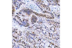 IHC analysis of STAG2 using anti-STAG2 antibody (ABIN7602420).