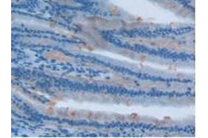 IHC-P analysis of Rat Intestine Tissue, with DAB staining. (Involucrin Antikörper  (AA 461-551))