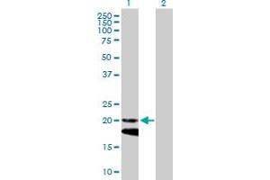 Western Blot analysis of IFNA4 expression in transfected 293T cell line by IFNA4 MaxPab polyclonal antibody. (IFNA4 Antikörper  (AA 1-189))