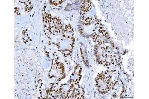IHC analysis of SP1 using anti-SP1 antibody (ABIN7601559). (SP1 Antikörper  (AA 384-603))