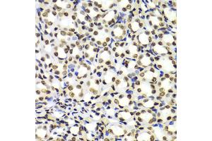 Immunohistochemistry of paraffin-embedded Rat kidney using Dimethyl-Histone H3-K4 antibody (ABIN5969803) at dilution of 1/100 (40x lens). (Histone 3 Antikörper  (H3K4me2))