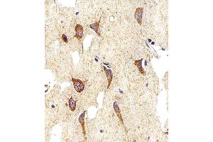 Immunohistochemical analysis of paraffin-embedded H. (Myosin Antikörper  (AA 654-668))