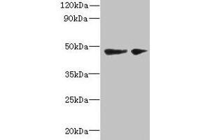 Western blot All lanes: SLC25A46 antibody at 6 μg/mL Lane 1: Mouse brain tissue Lane 2: Jurkat whole cell lysate Secondary Goat polyclonal to rabbit IgG at 1/10000 dilution Predicted band size: 47, 31, 38 kDa Observed band size: 47 kDa (SLC25A46 Antikörper  (AA 1-102))