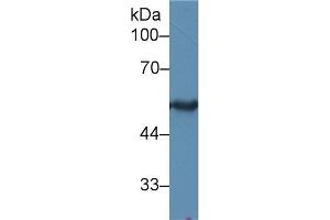 Western Blot; Sample: Rat Skin lysate; Primary Ab: 2µg/ml Rabbit Anti-Human KRT15 Antibody Second Ab: 0. (KRT15 Antikörper  (AA 274-399))