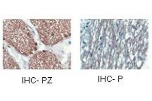 CNP antibody staining of oligodendrocyte lineage cells in the human optic nerve and/or spinal cord. (Cnpase Antikörper  (Middle Region))