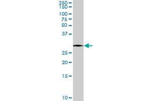 PLP1 MaxPab rabbit polyclonal antibody. (PLP1 Antikörper  (AA 1-277))