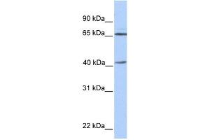 WB Suggested Anti-GLA Antibody Titration: 0. (GLA Antikörper  (N-Term))